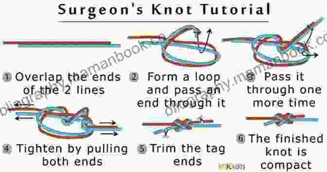 Diagram Of A Surgeon's Knot The Useful Knots Book: How To Tie The 25+ Most Practical Rope Knots (Escape Evasion And Survival)
